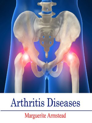 cover image of Arthritis Diseases